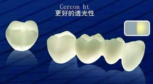 泽康（cercon）氧化锆全瓷牙好不