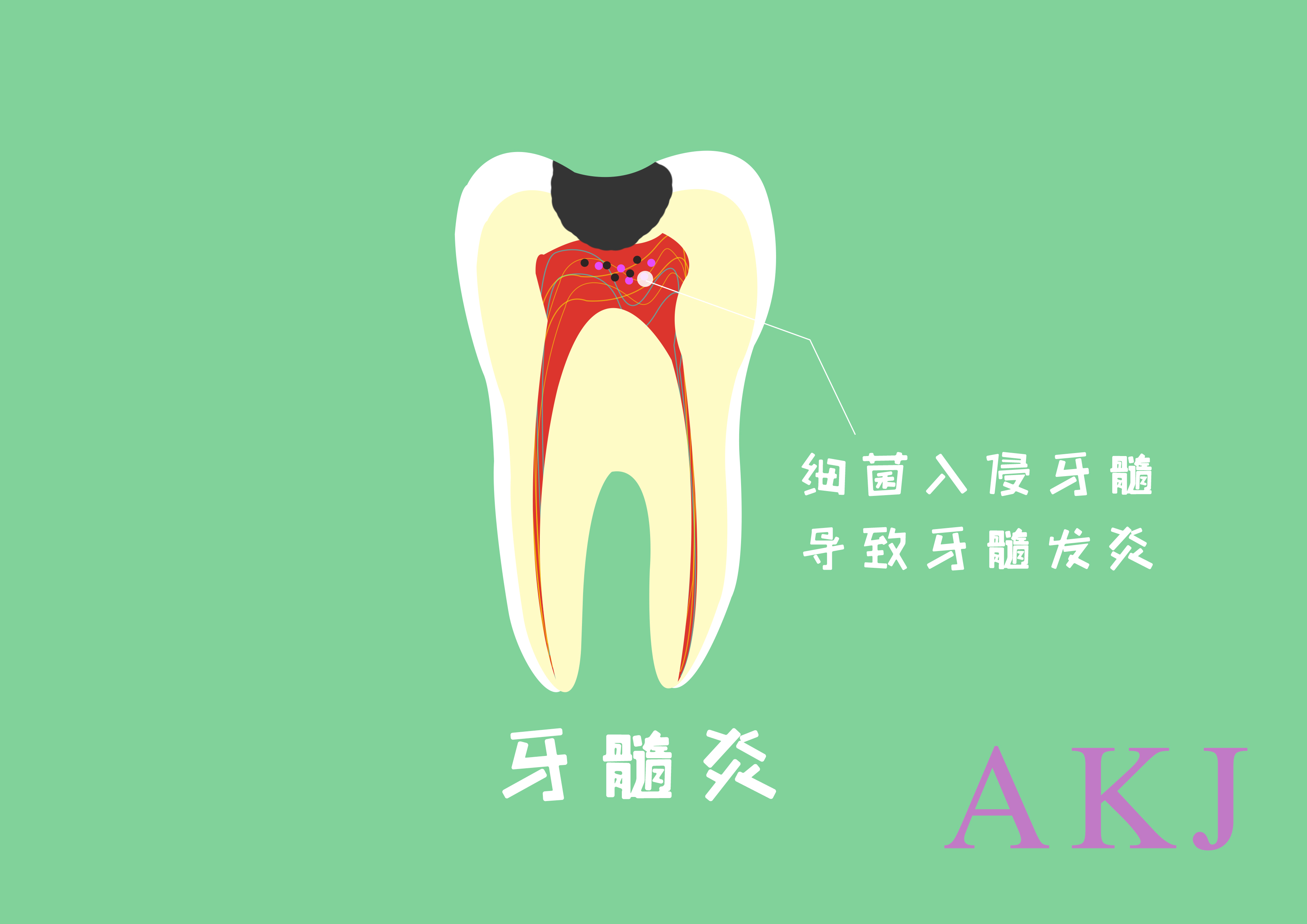 渡江口腔优秀病例展示 | 慢性牙髓炎治疗_患者