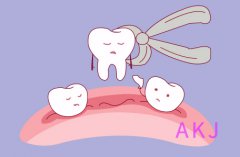正畸拔牙能把牙齿往回收多少毫米