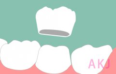 缺失多颗牙齿不建议做烤瓷牙连冠修复，这是为什么？