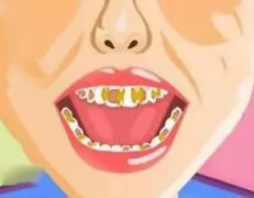 烟渍牙有哪些危害？还有得