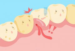种植牙牙龈发炎是什么原因