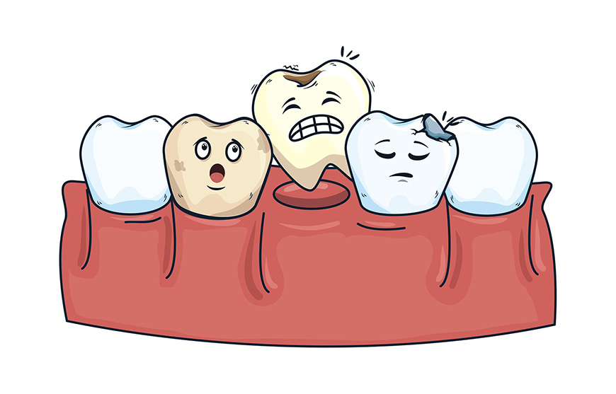 牙齿酸痛