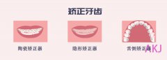 深圳暑假矫正牙齿|哪种矫正方法比较好？