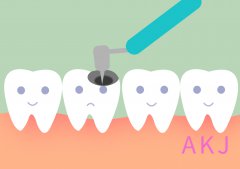 补牙相关的7大常见问题