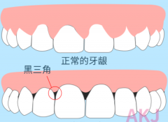 正畸科杜艺平主任|矫牙过程怎么避免牙龈萎缩？
